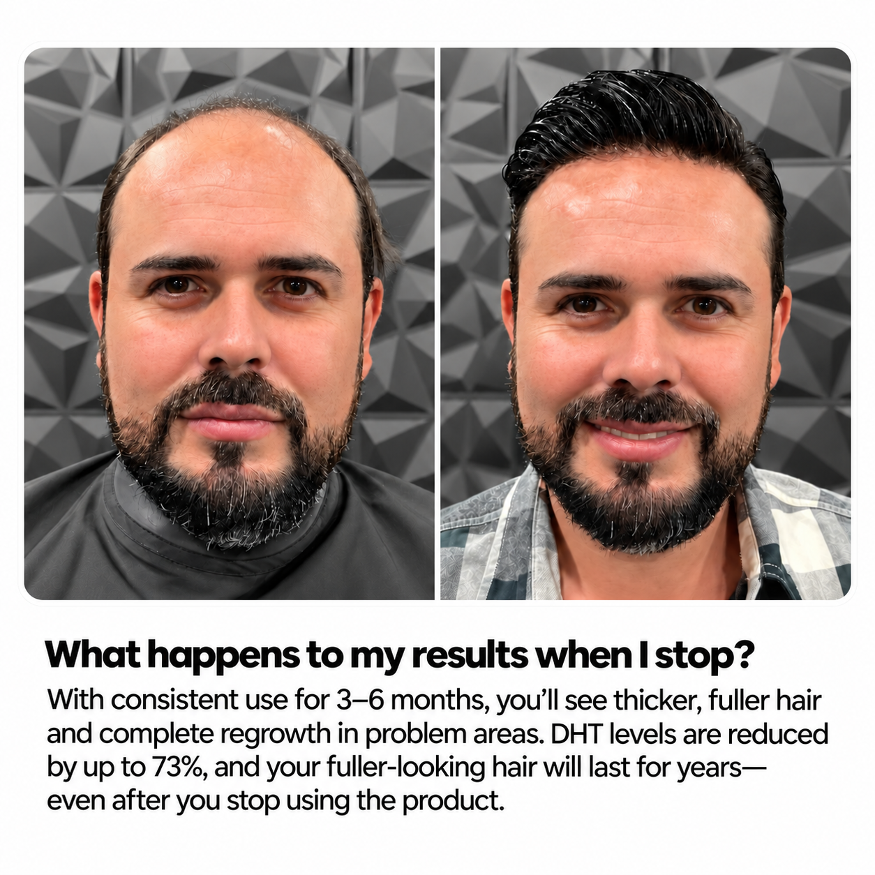 ROOTVELL Hair Regrowth System